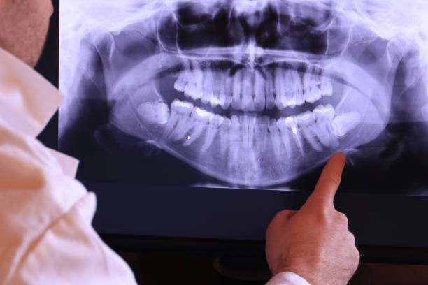 Best Dentist for Severe Toothache  in Barton Creek, TX