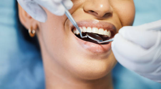Best Urgent Tooth Repair  in Barton Creek, TX